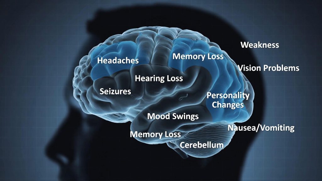 ব্রেন টিউমার কি পুরোপুরি নিরাময়যোগ্য